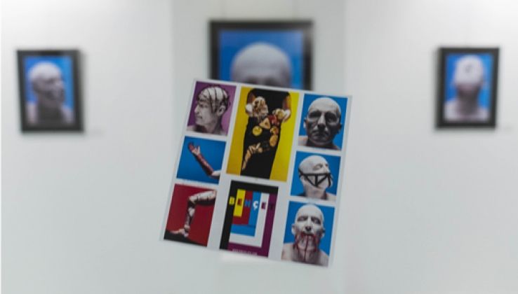 Francisco Tamayo expone sobre el s&iacute;ndrome de Beh&ccedil;et en la Galer&iacute;a Alfareros