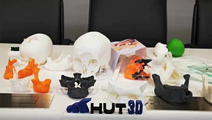 El Hospital Torrec&aacute;rdenas crea una Unidad de Biomodelado e Impresi&oacute;n 3D