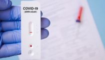 Los farmac&eacute;uticos reclaman coordinaci&oacute;n epidemiol&oacute;gica para los test autodiagn&oacute;stico